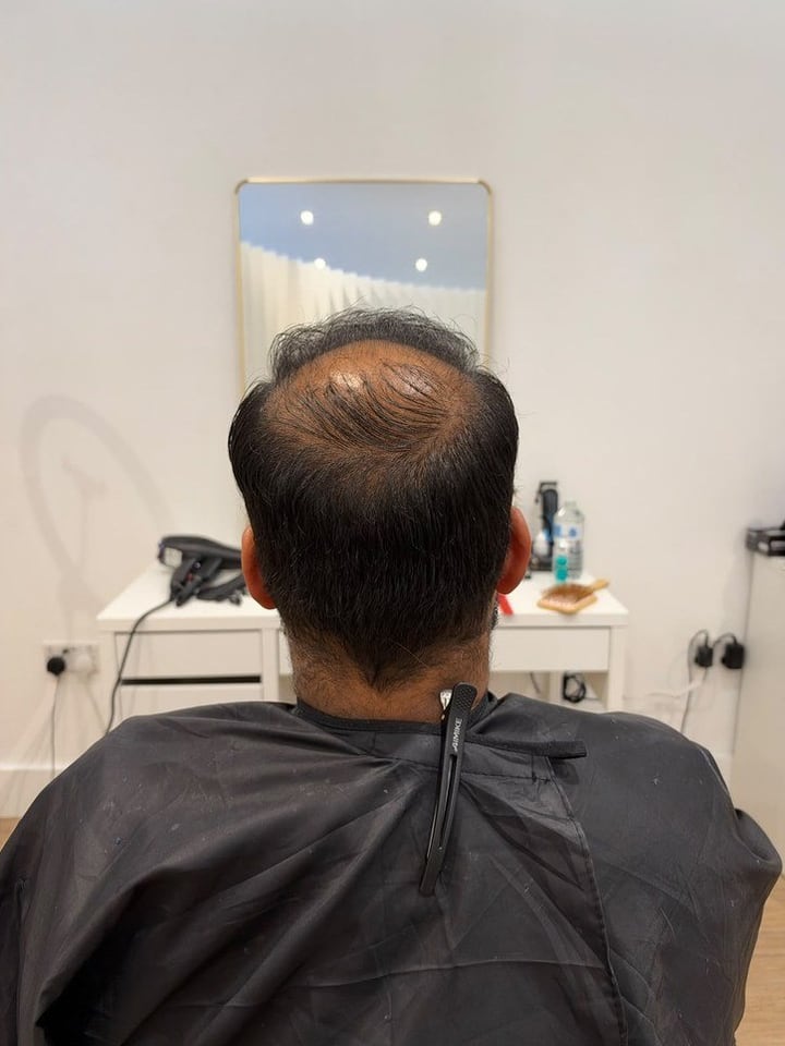 Real client before: thinning crown
