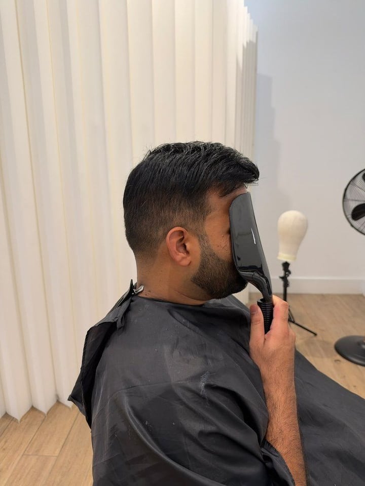 Real client 1 after hair system, left side profile