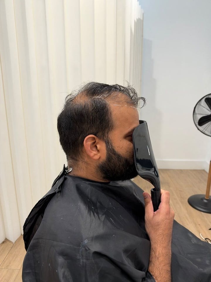 Real client 1 before, left side profile