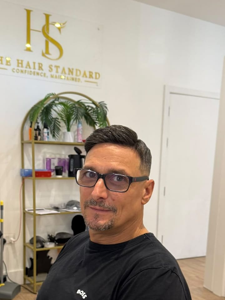 Real client 2 after hair system, front view
