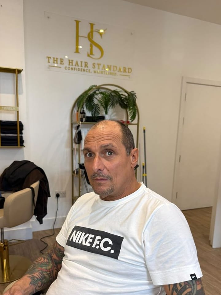 Real client 2 before, front view