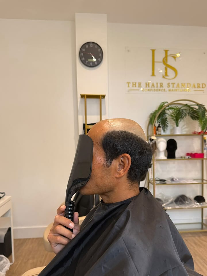 Real client 3 before, side view, finished look